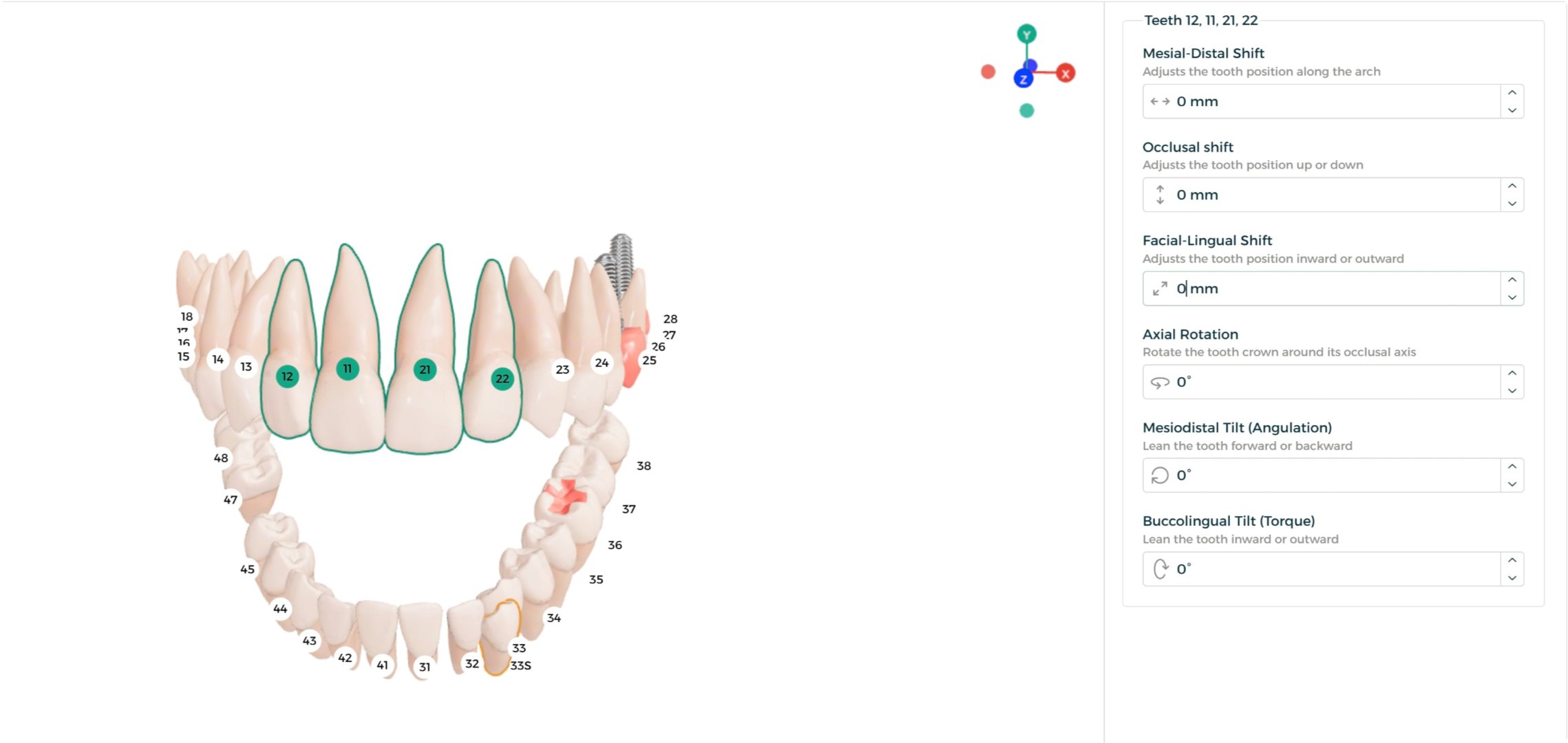 Step 3 - Multiple teeth repositioned together