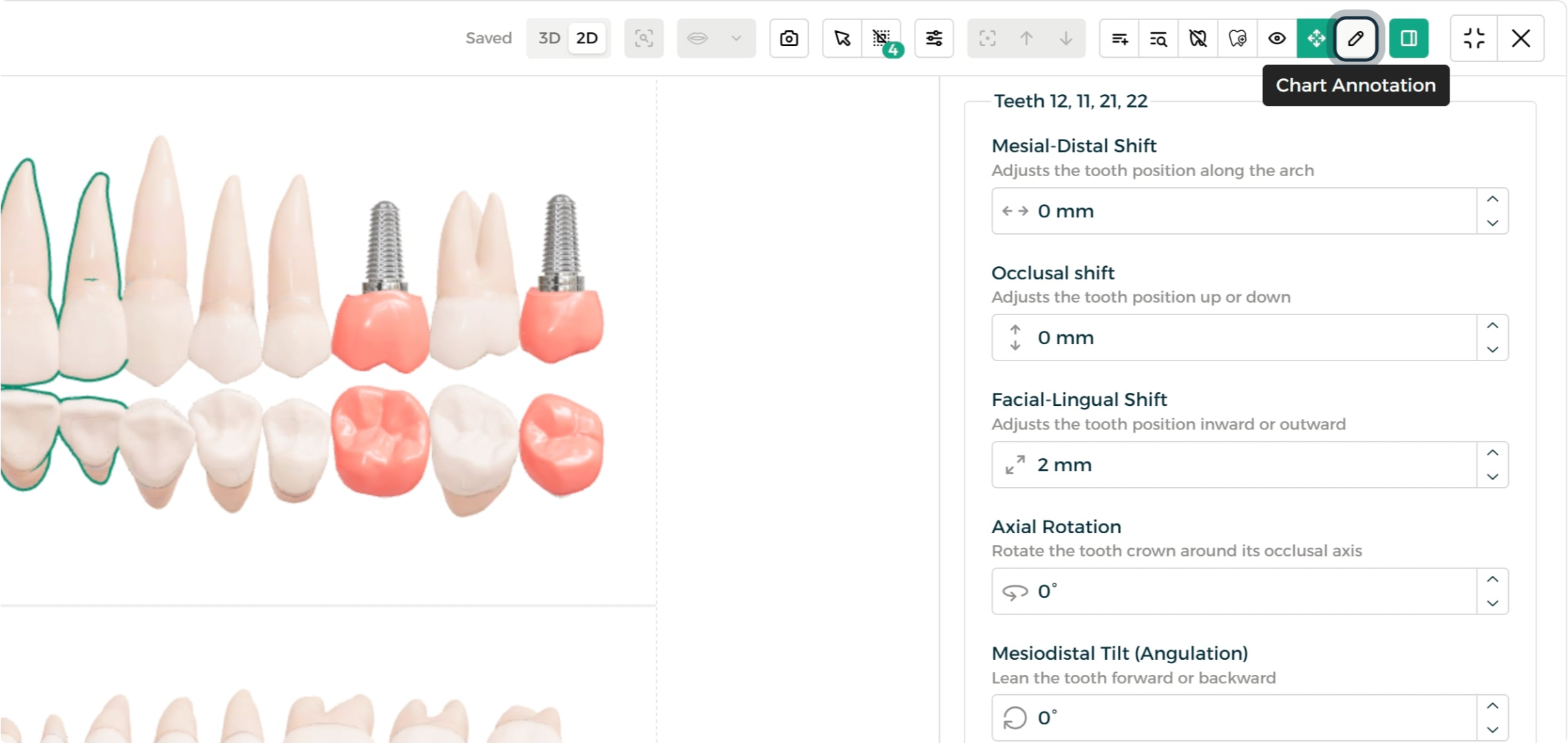Step 2 - Chart Annotation tools